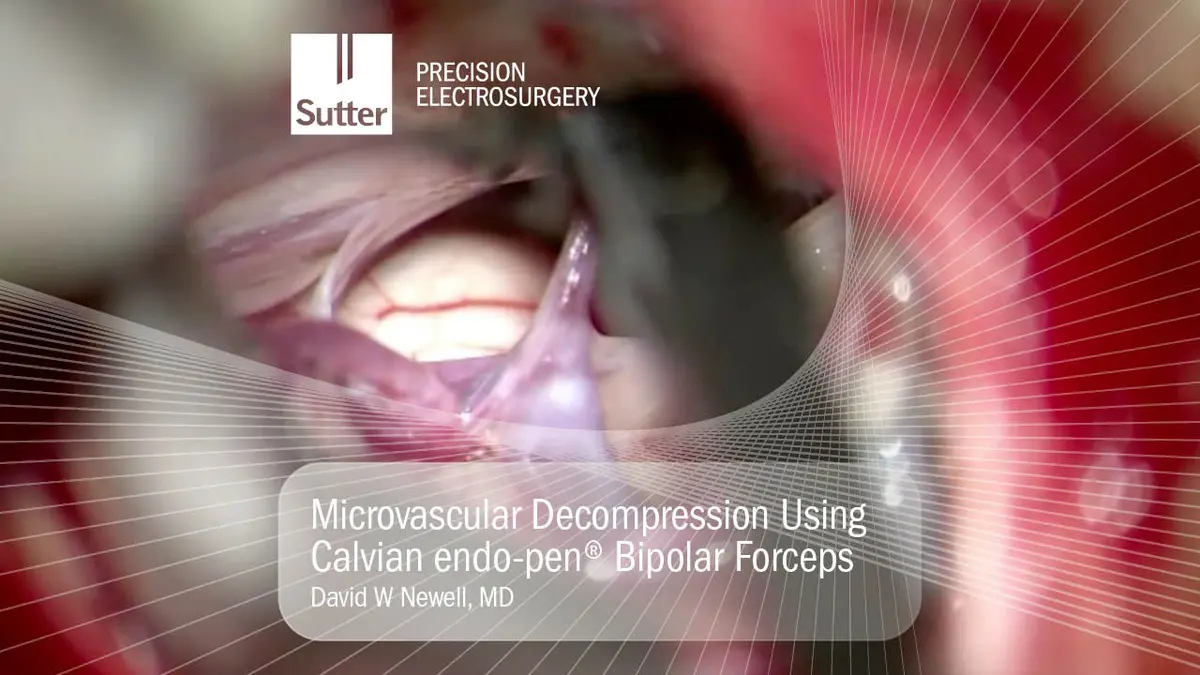 Microvascular decompression procedure using Calvian endo-pen® bipolar forceps by David W Newell, MD