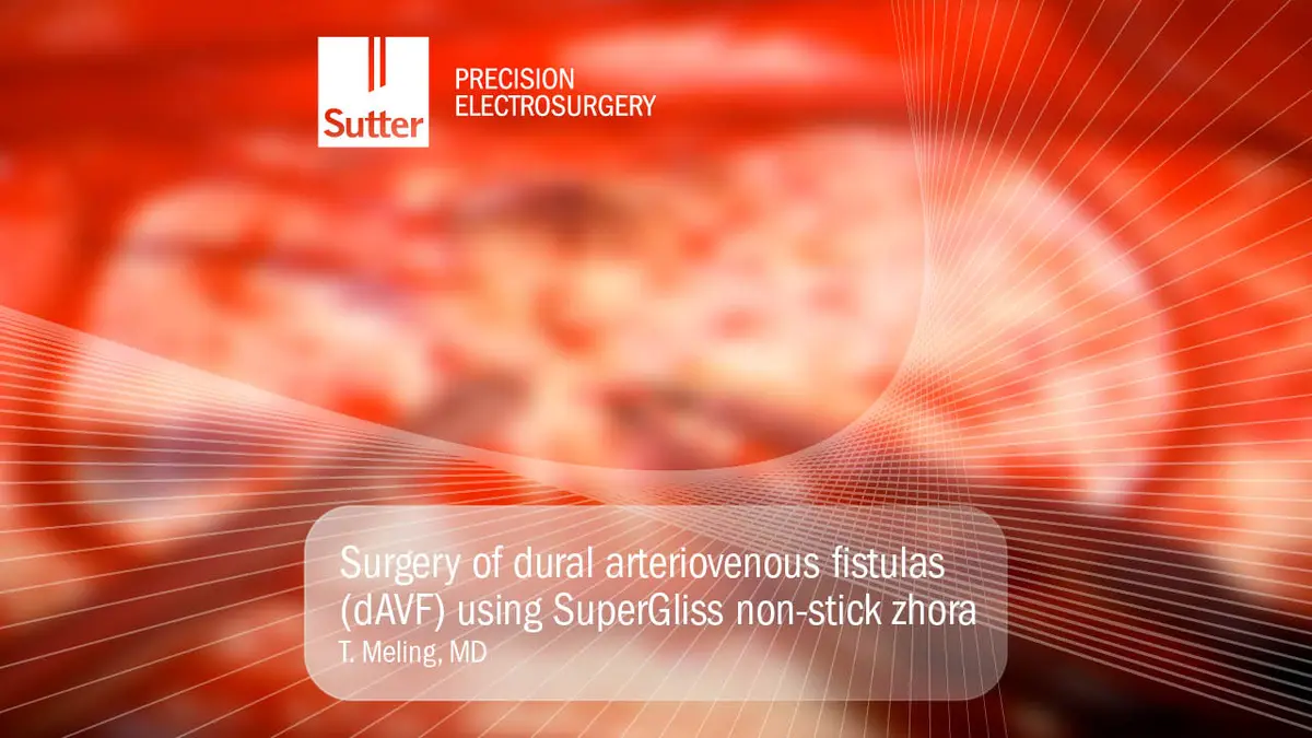 Neurochirurgischer Eingriff zur Behandlung duraler arteriovenöser Fisteln mit SuperGliss non-stick zhora Pinzette, durchgeführt von Dr. T. Meling