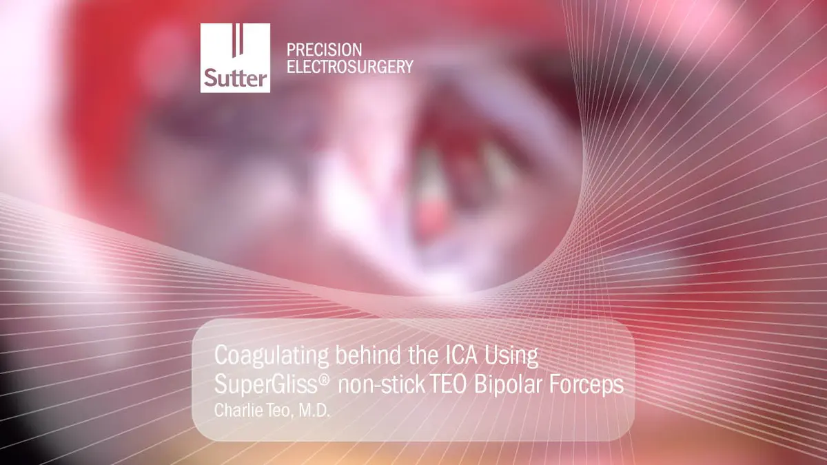 Blurred Surgical close-up showing coagulation behind the ICA using SuperGliss® non-stick TEO bipolar forceps by Charlie Teo, M.D.