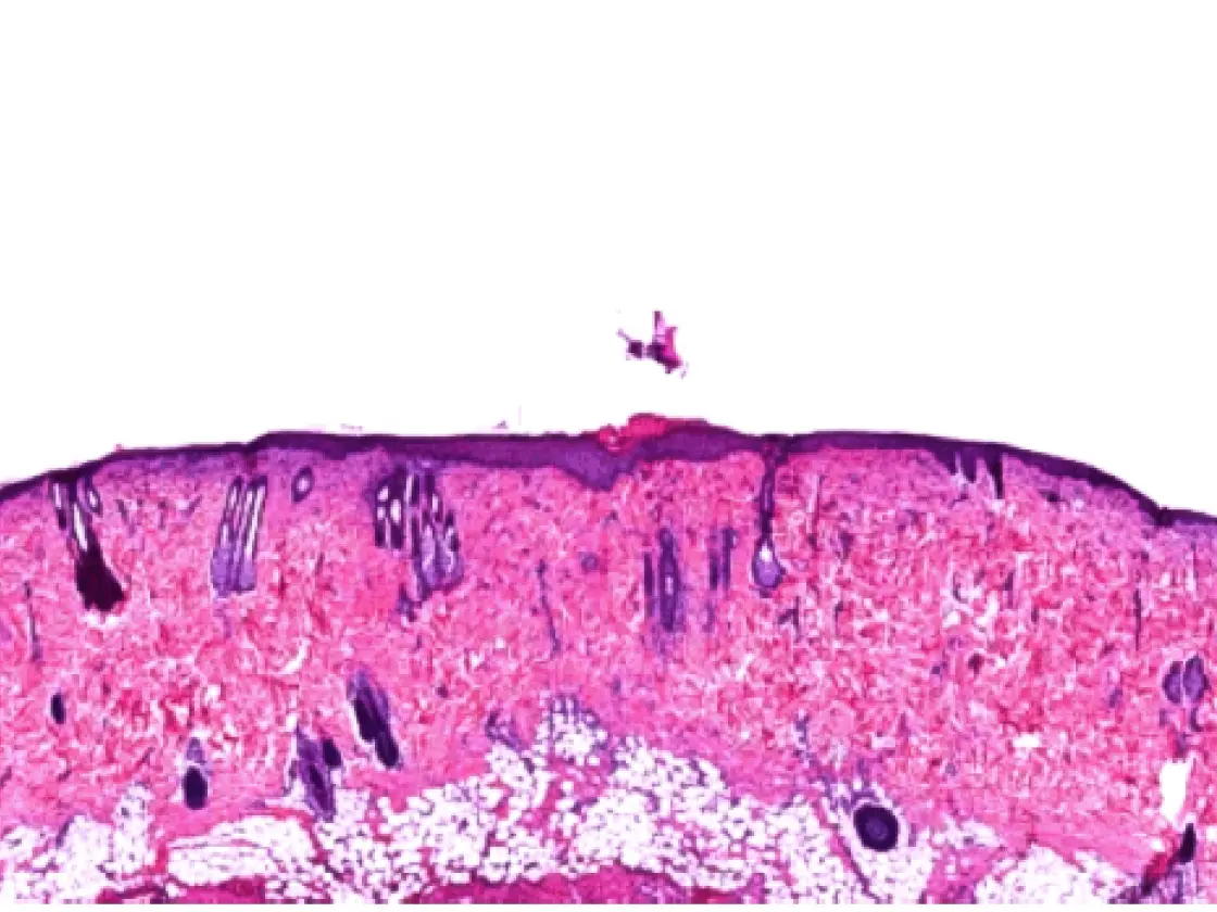 Histologischer Schnitt von Hautgewebe, gefärbt mit Hämatoxylin und Eosin (H&E) – sichtbare Schichten von Epidermis und Dermis mit Haarfollikeln und Drüsenstrukturen