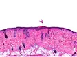 Histologischer Schnitt von Hautgewebe, gefärbt mit Hämatoxylin und Eosin (H&E) – sichtbare Schichten von Epidermis und Dermis mit Haarfollikeln und Drüsenstrukturen